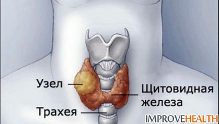 Dacă glanda tiroidă apasă sau suferă