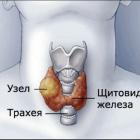 Якщо тисне або болить щитовидна залоза