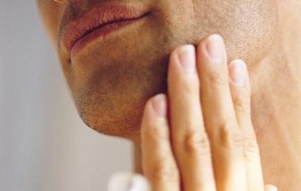 Cum rasul poate declansa sicoza vestibulului nasului