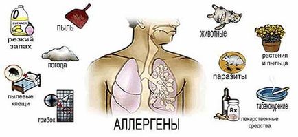 Як перемогти алергію