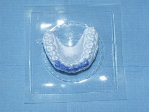 Капов відбілювання зубів, стоматологічна клініка 