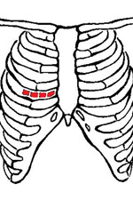 Cardiochirurgia defectelor valvei mitrale a inimii, spitalul orașului nr. 40