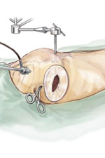 Cardiochirurgia defectelor valvei mitrale a inimii, spitalul orașului nr. 40