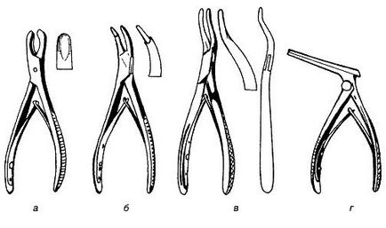 Taierea oaselor - stomatologie, instrumente dentare - chirurgie și tratament