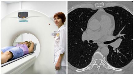 CT a organelor toracice care arată indicațiile și contraindicațiile
