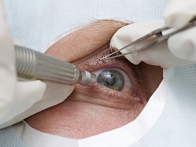 A glaukóma kezelése Németországban