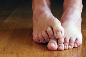 Tratamentul ciupercilor pe picioare cu remedii folclorice
