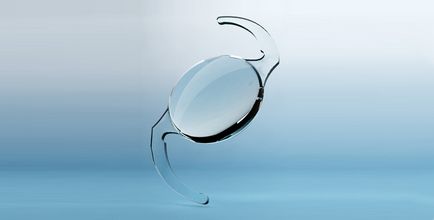 Cataracta lentilă artificială de tratament întoarce viziune, articole de sănătate, medes asociație