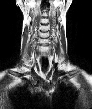 Mr joncțiune craniovertebral în souhao (zhulebino, vykhino, kotelniki), clinica modernă