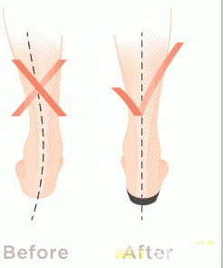 Flip flops ortopedice masculi vionice de ortehel