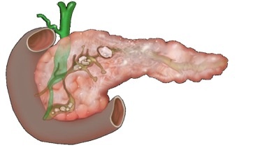 Medicină tradițională - tratamentul pancreasului