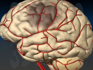 Олігодендроцітома головного мозку анапластична і високодиференційована лікування, скільки живуть