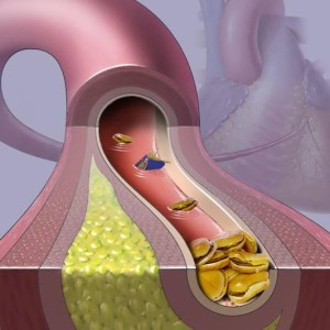 Descrierea și structura aortei