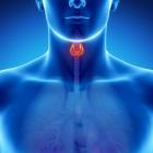 Umflarea limbii în gât, din care motive sunt patologia diagnosticului și a tratamentului