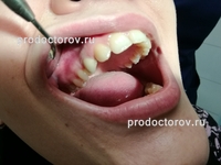 Értékelés 10 beteg a fogászati ​​klinika - amerikai mosoly - Ufa