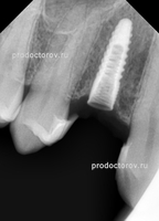 Opinii 10 pacienți despre clinica dentară - zâmbetul american - în Ufa