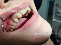 Відгуки 10 пацієнтів про стоматологічну клініку - американська посмішка - в Уфі