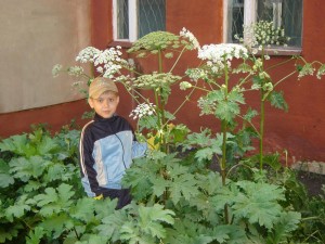 Опік борщівник перша допомога при ураженні шкіри, допомога при опіках