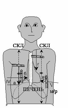 Percuție - stadopedia