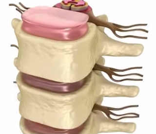 Cauzele osteocondrozei