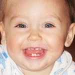 Dentiție dinți la copii - cum să ușureze dentiția, copilul nostru sănătos