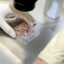 vitro megtermékenyítés eljárás képzés, technológia, szakaszait meddőségi kezelés