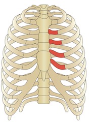 Tratamentul chondritei cronice, simptome, cauze