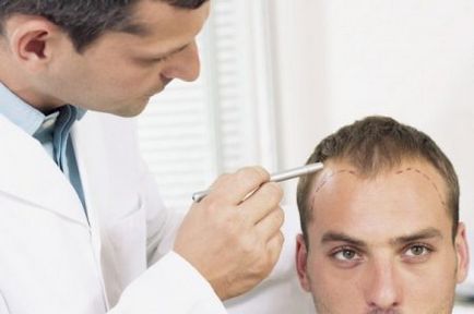 Scopul alopeciei, descrierea, tratamentul