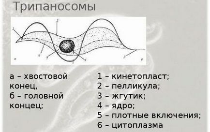 Сонна хвороба (африканський трипаносомоз) збудник, симптоми