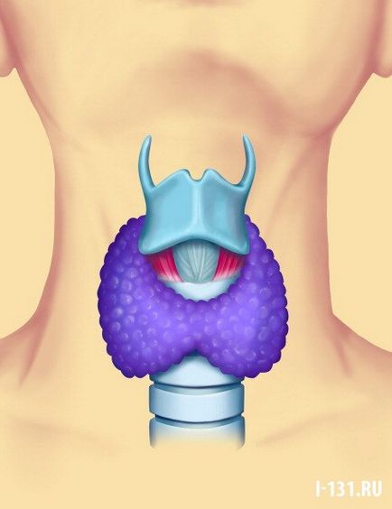 Specialiștii moderni recomandă ca o operațiune de alegere în patologia glandei tiroide