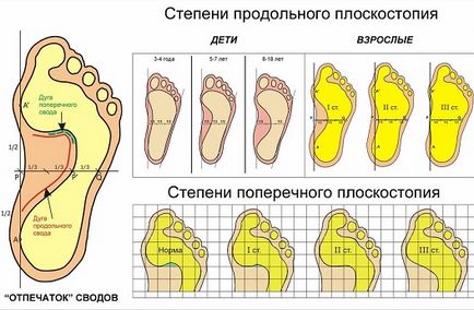 Устілки ортопедичні на замовлення!