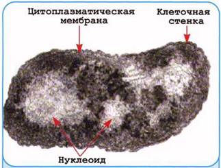 Структура бактеріальної клітини