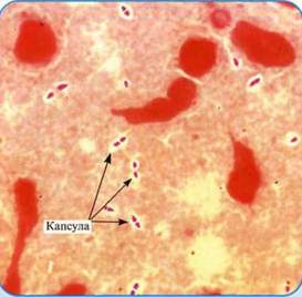 Structura unei celule bacteriene