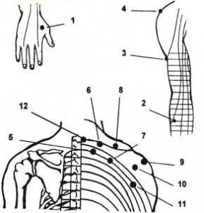 Точковий масаж при остеохондрозі шийного відділу