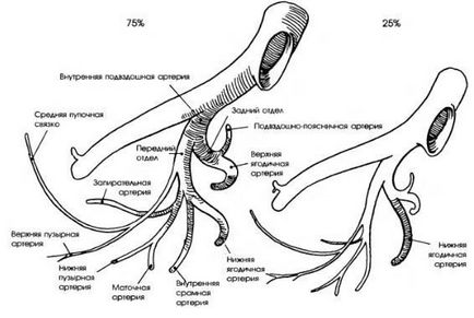 Eliminarea reperelor anatomice ale ganglionilor limfatici pelvieni