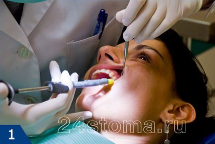 Видалення зуба мудрості особливості проведення операції