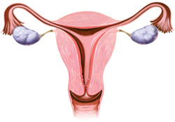 Examinarea cu ultrasunete a organelor pelvine (ultrasunete pelvine)