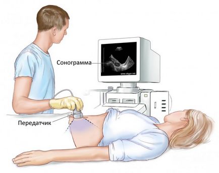 Узі органів малого таза підготовка