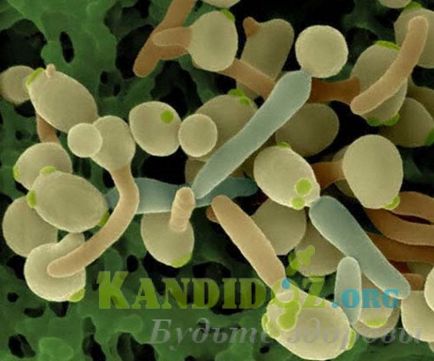 A zsigeri candidiasis (rendszer) (szisztémás candidiasis) A zsigeri candidiasis (rendszer)