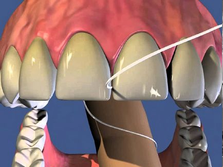 Зубна нитка - як вибрати, види і рекомендації, місто дент
