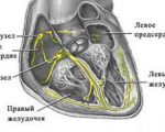 Aorta stenosis okai, tünetei, diagnózisa és kezelése