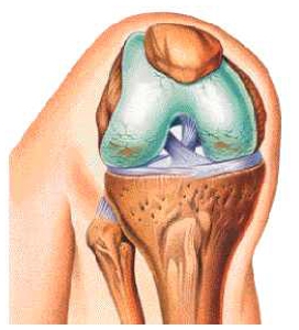 Osteoarthritis a térdízület, térdízület gonartrózis kezelés fokú térdízületi osteoarthritis,