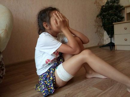 Un câine cu lanț a mușcat o fată de 8 ani în Novocheboksarsk pe 14 iulie 2017, știri despre Chuvashia,