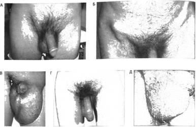 Diagnosticul diferențial al herniilor abdominale, tactici terapeutice - chirurgie - material online on-line