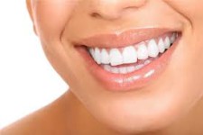 Домашні способи відбілювання зубів