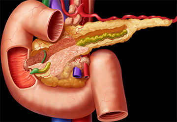 Enzime pentru pancreas - medicamente și utilizarea lor