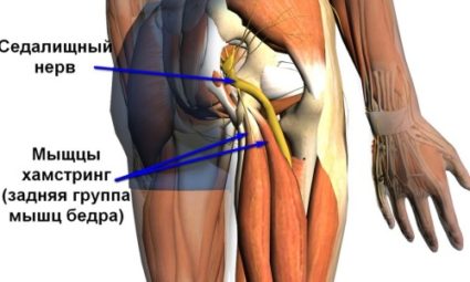 Cum să identificați și să tratați sciatica