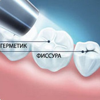 Hogyan készítsünk ipari kézműves 2 generátor