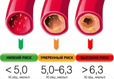 Крапельниці для очищення крові і всього організму людини