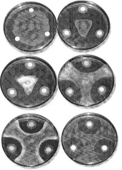 Diagnosticul malariei, tratamentul, prevenirea